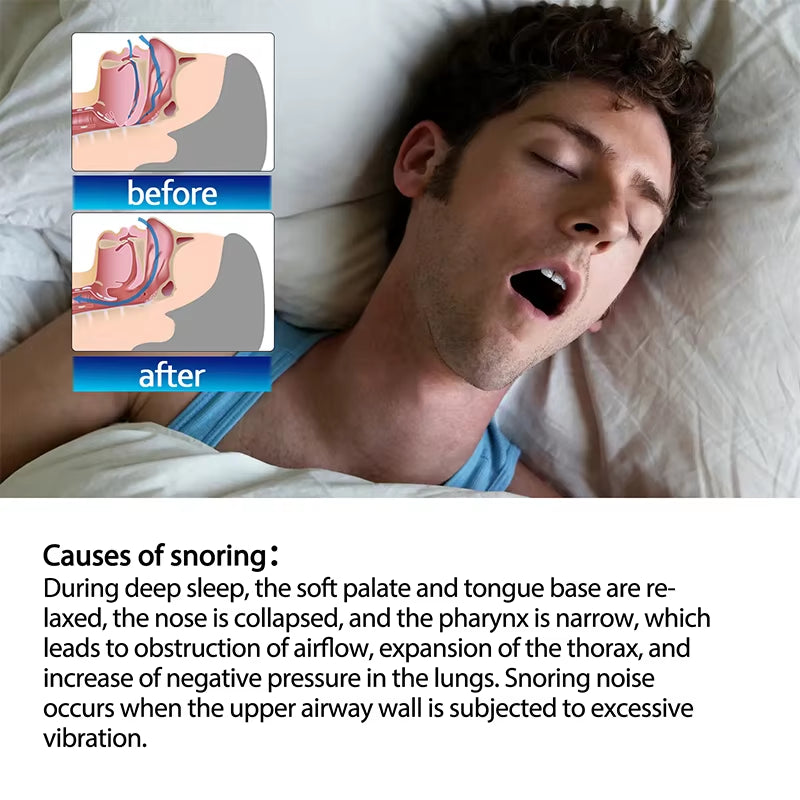 5/10Pcs anti Snoring Sleep Strips Sticker Gentle Less Mouth Seal Tape Stop Snore Mouth Correction Sticker Tape